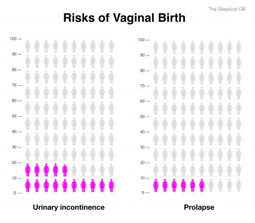 Comparing Long Term Risks Of Vaginal Birth And C Section The Skeptical Ob